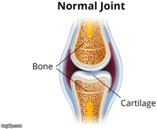 Επιθέματα ανακούφισης πόνων γονάτων