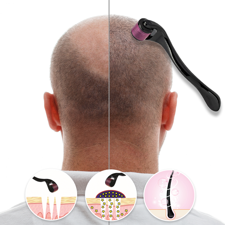 Κύλινδρος μασάζ αντιμετώπισης Τριχόπτωσης και  Ραγάδων