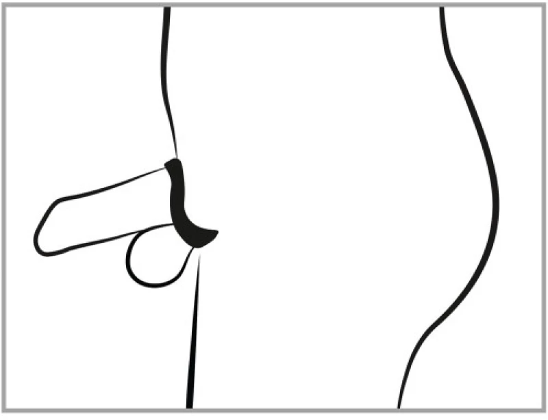 Curved Cock Cage with Ball Rings and Dilator