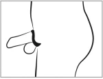Curved Cock Cage with Ball Rings and Dilator