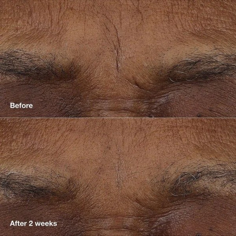 Clinique Smart Clinical Repair™ AM/PM Retinoid Balm 3g
